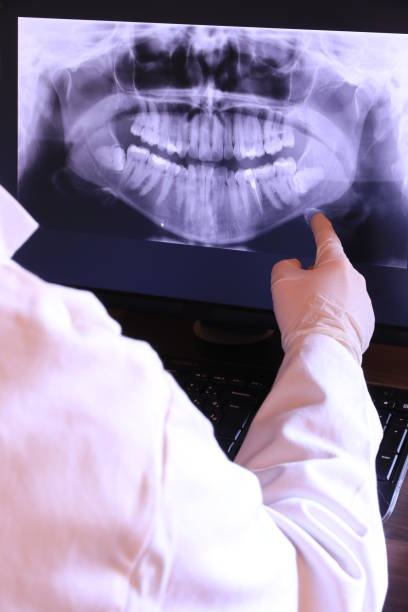 Best Emergency Dental Care for Broken or Chipped Teeth in Greenfield, IL